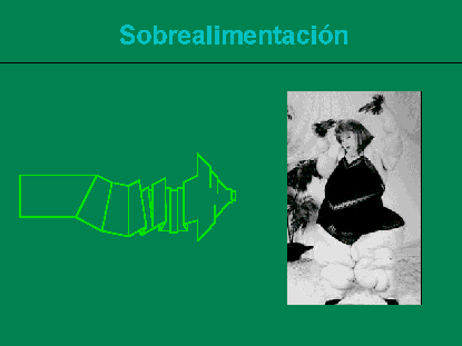 Obesidad Extrema